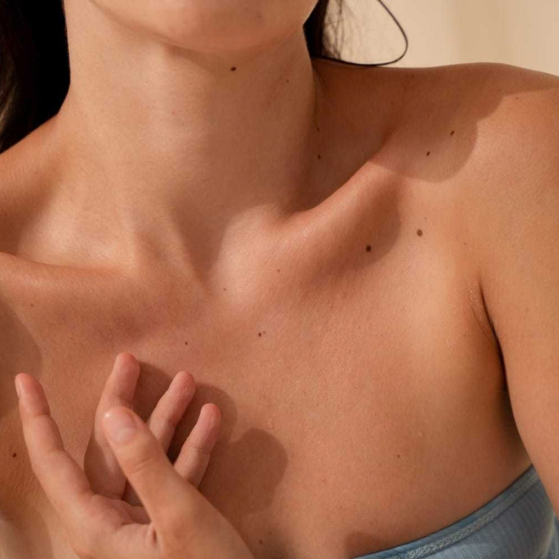 AGE's and skin health
