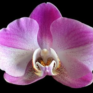 How is Your Vagina Aging?